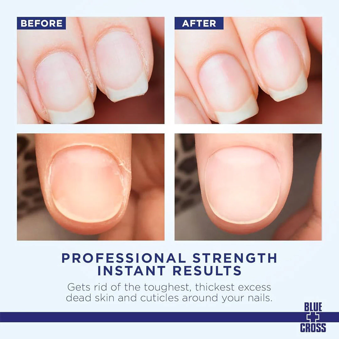 Blue Cross Cuticle Remover 32Oz #4219 - Image 3