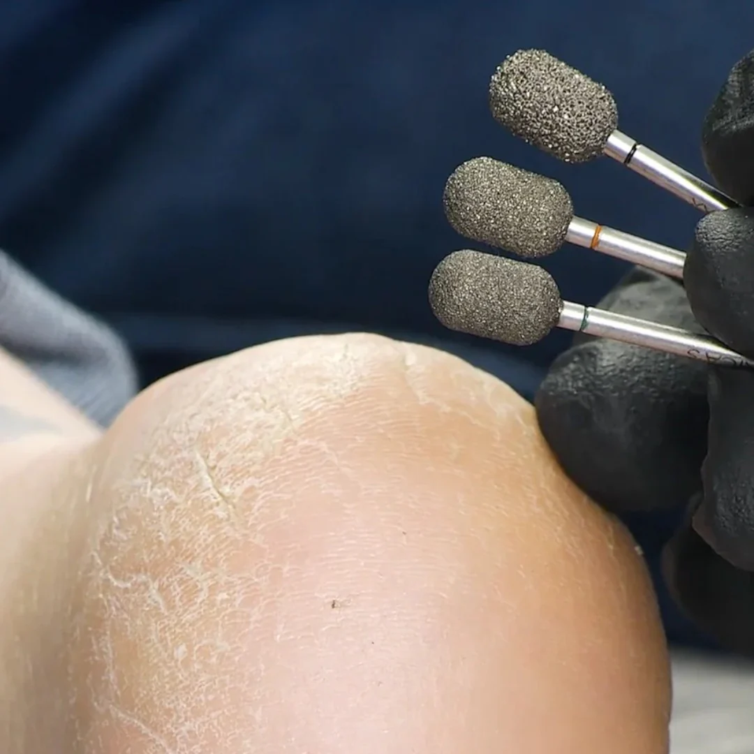 Erica's ATA Nail Drill Bits - Torch Pedicure 3/32 - Image 3