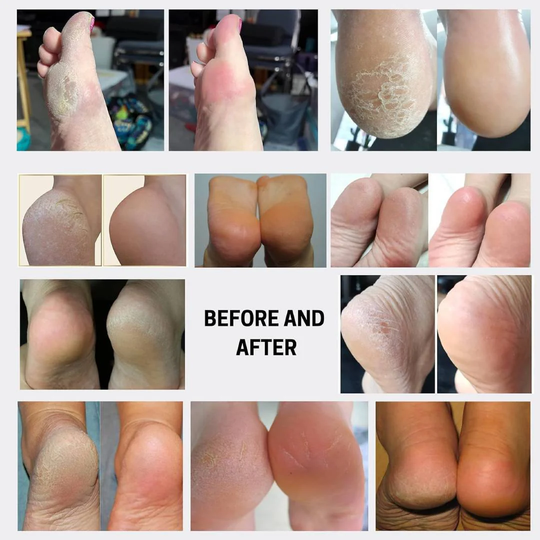 Estemio Therapy In Salon - Foot Bubble Softener 80Ml - Image 3