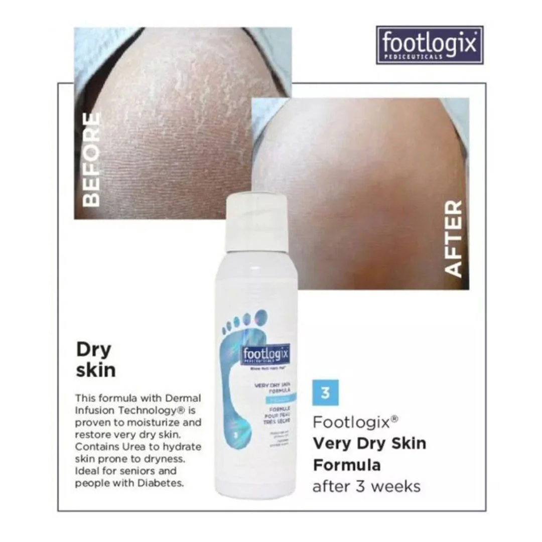 Footlogix #3 Very Dry Skin Formula 10.2oz - Image 2