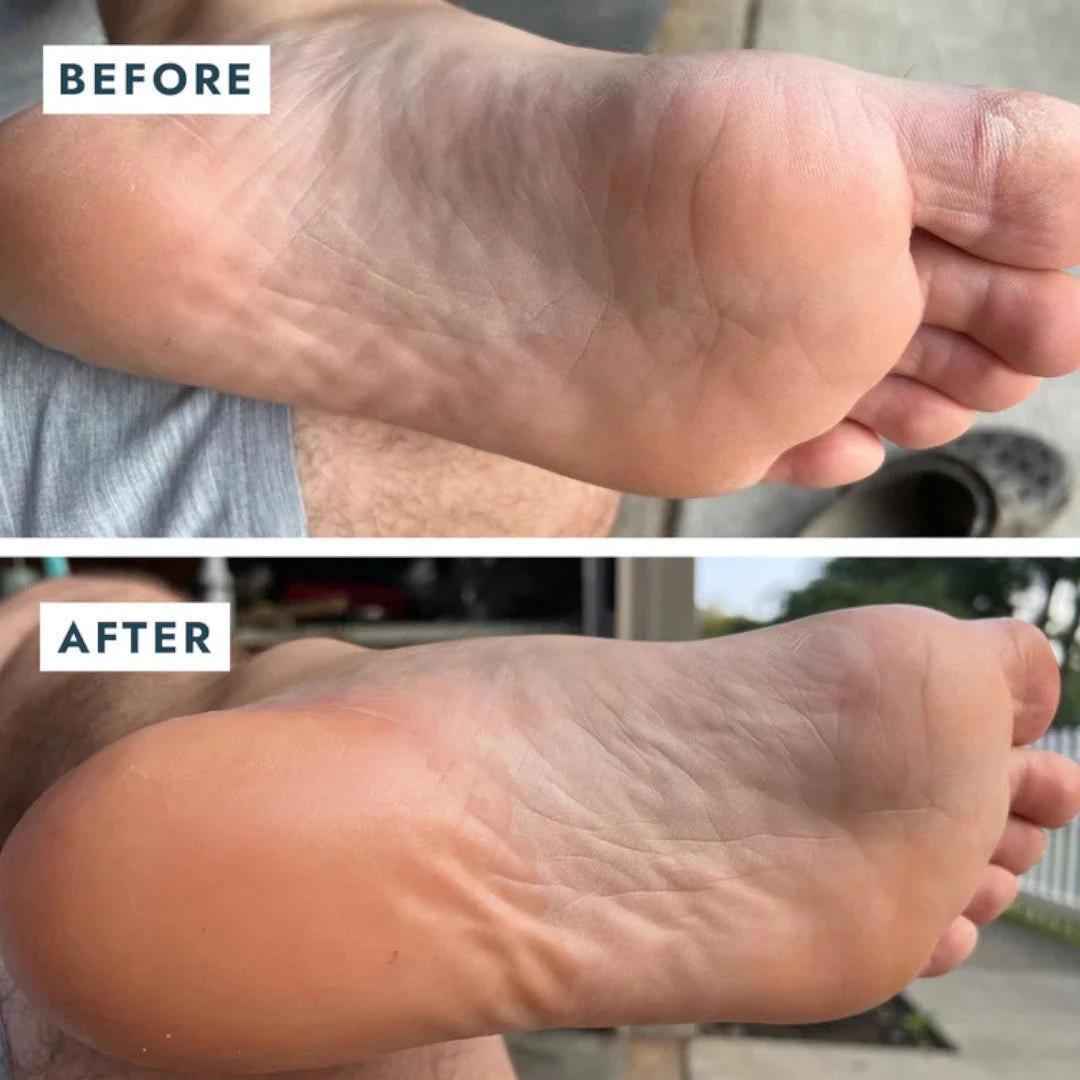 Voesh Solemate Heel Repair Balm - Image 6